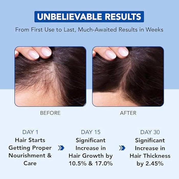 Botanic Hearth Hair Oil for Hair Growth | Rosemary Oil for Hair Growth with Biotin, Castor & Jojoba | Scalp Oil & Dry Scalp Treatment | Color Safe | All Hair Types | 6.7 Fl Oz - Image 4